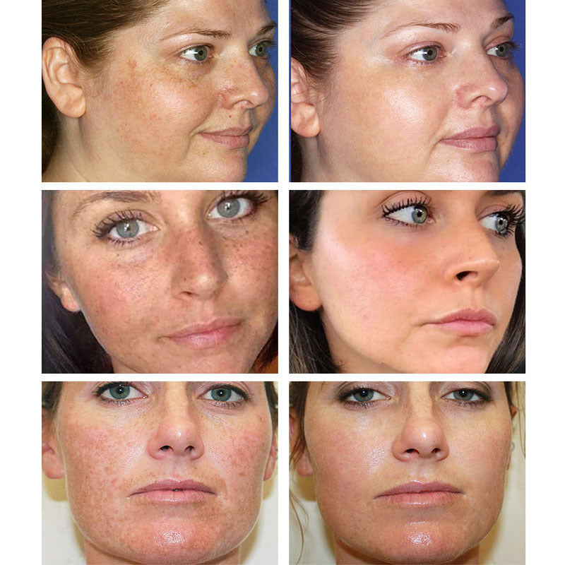 Moisturizing Cream Pore Shrinking Cream Moisturizing Cream Pore Shrinking Cream